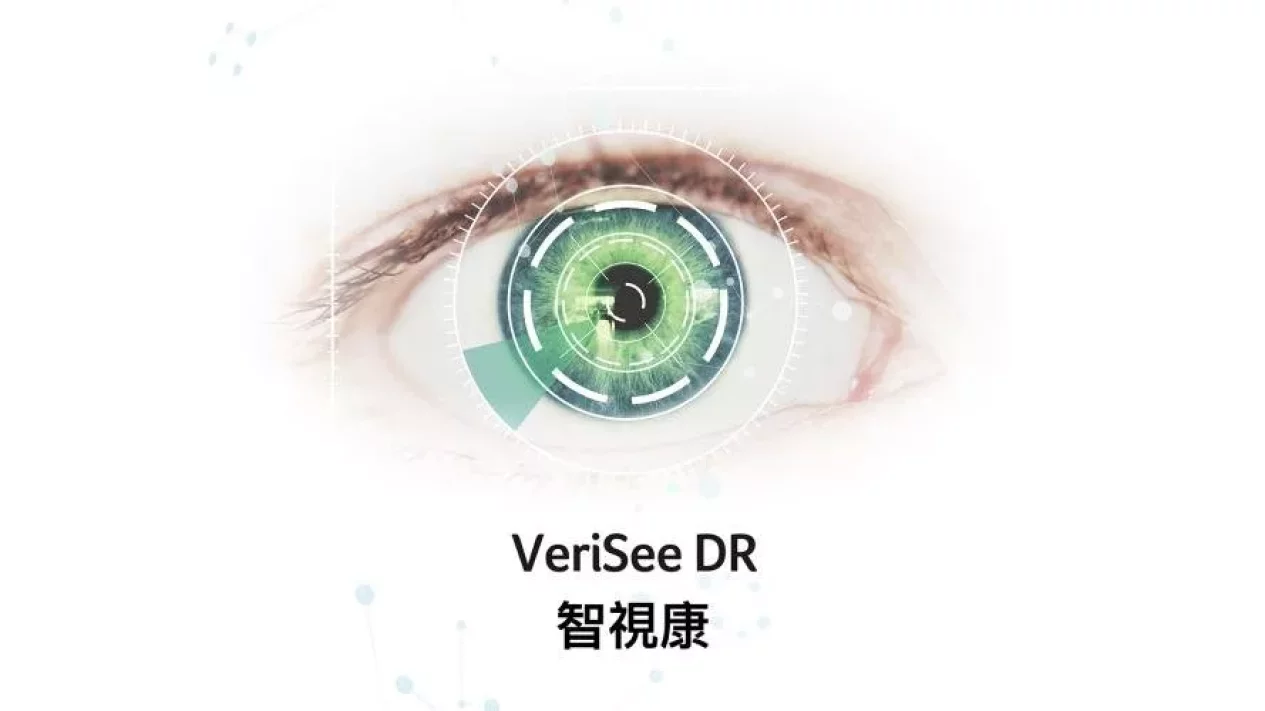 Mata Anda Kini Bisa Bicara Lewat AI: Acer Medical Hadirkan 3 Modul AI di VeriSee